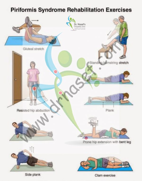 Piriformis Syndrome Rehab Drnasef