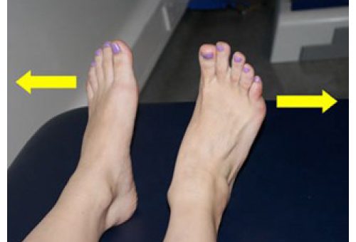 Foot Sprain Excercise