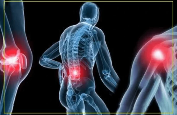 Arthritis-إلتهاب المفاصل