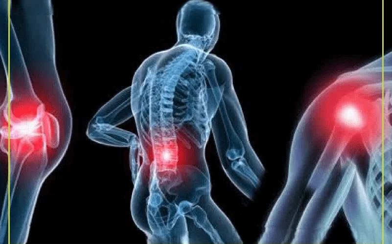 Arthritis-إلتهاب المفاصل