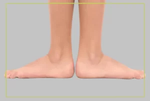 التحالف-القدمي