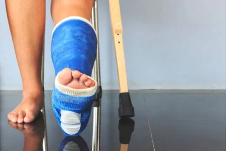 بعد-جراحة-القدم