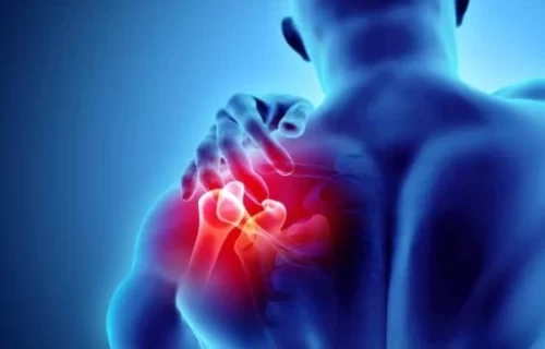 shoulder-surgery-جراحة الكتف